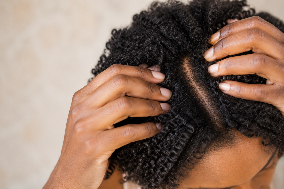 Cuir chevelu sec ou déshydraté : comment faire la différence et quoi faire ?
